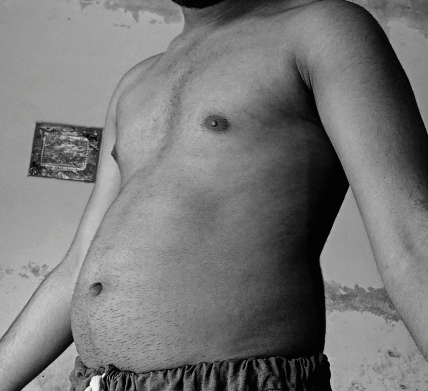 Before - body