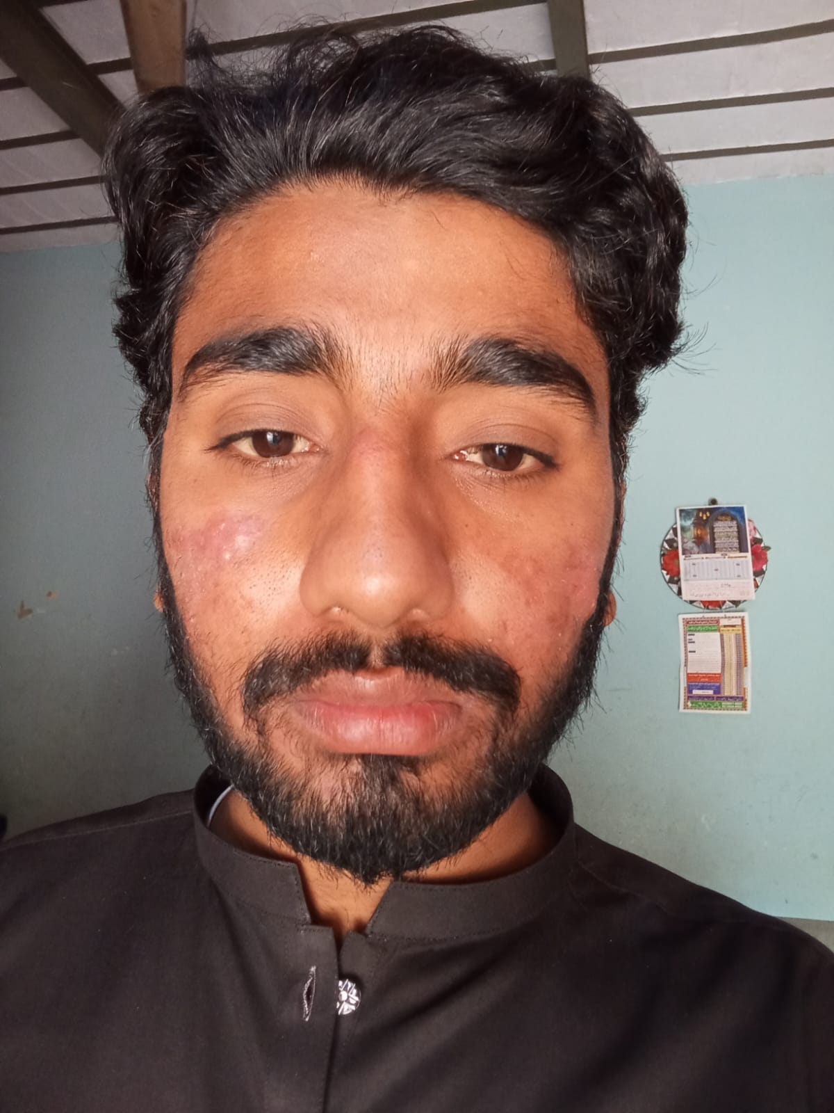 Before - face